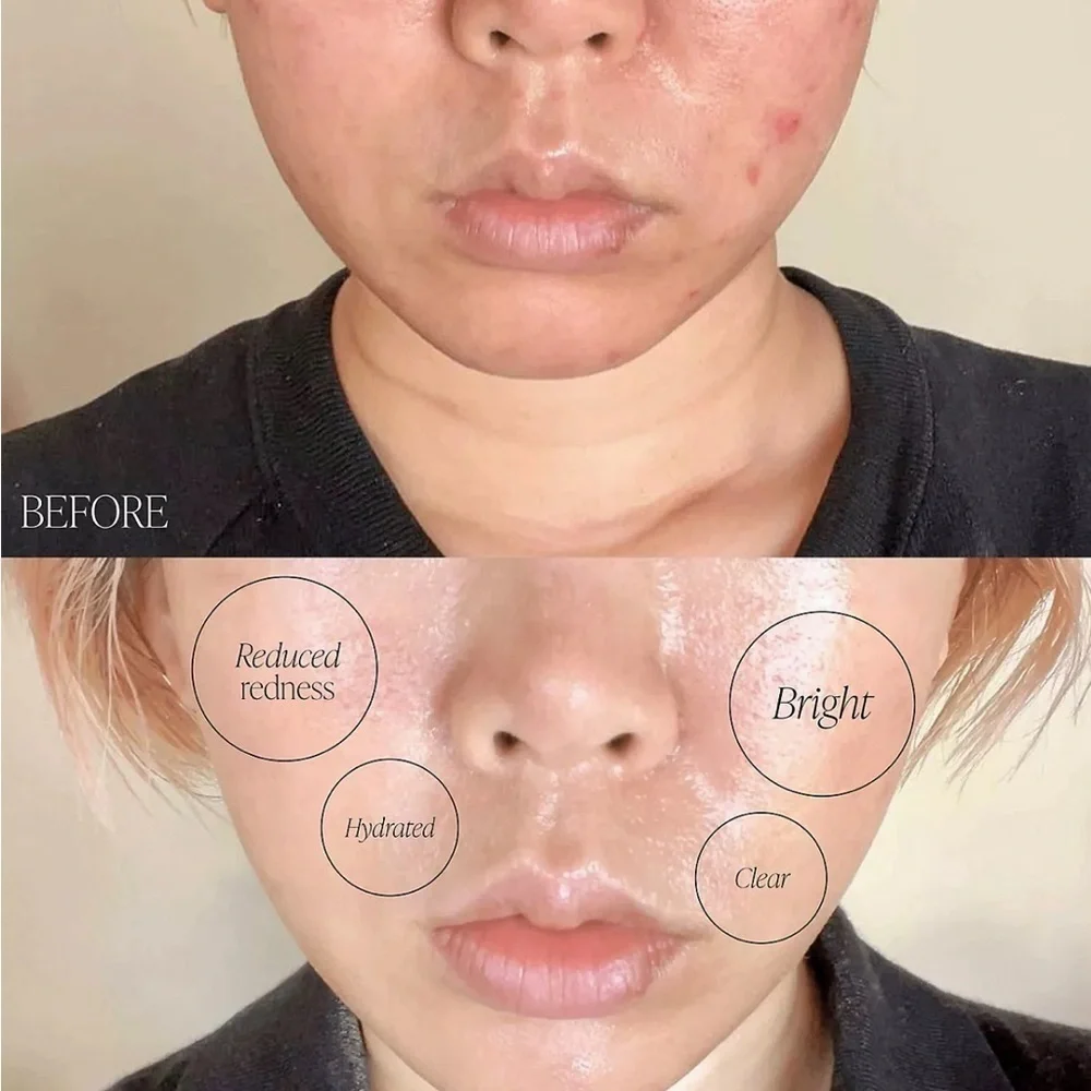 Byroe Basil Dark Spot Correcting Cream